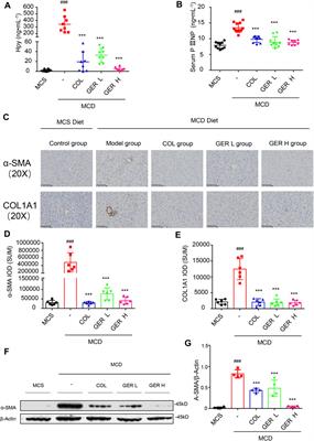 Germacrone Attenuates Hepatic Stellate Cells Activation and Liver Fibrosis via Regulating Multiple Signaling Pathways